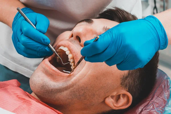 Klinika Stomatologiczna Pacjent Siedzi Krześle Dentystycznym Szeroko Otwartymi Ustami Dentysta — Zdjęcie stockowe