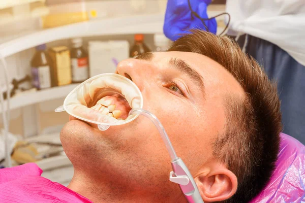 Procedure Dentist Dentist Prepares Patient Tools Remove Tartar Saliva Ejector — Stock Photo, Image