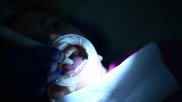 El dentista realiza la higiene bucal al paciente con ultrasonido. — Vídeo de stock