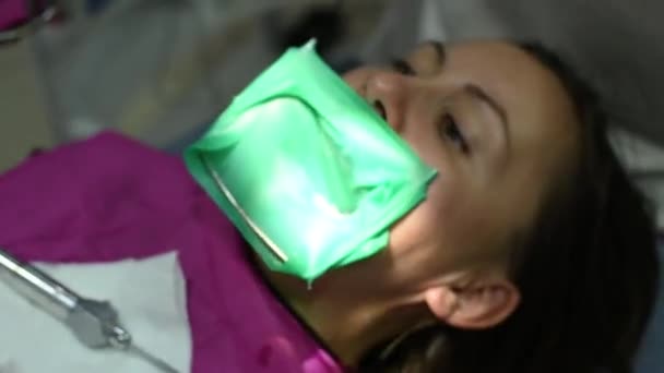 Стоматолог лечит зубы пациентов, использует резиновую плотину для качественного лечения. — стоковое видео