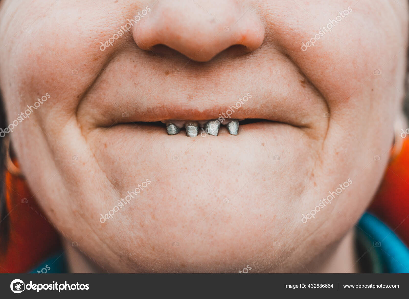 Woman Opened Her Mouth Wide Showed Her Crooked Rotten Teeth Stock Photo by  ©NIKO_Cingaryuk 432586664