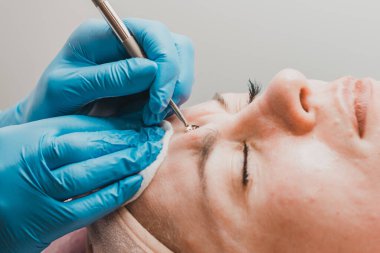 Mekanik yüz temizleme, yüzeyden cilt temizleme prosedürü ve derin kirlilik. yeni