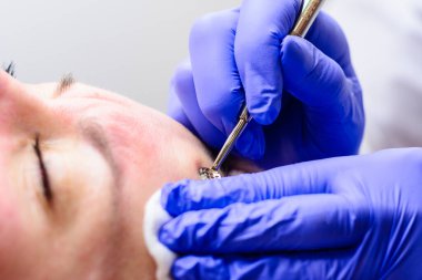 Mekanik yüz temizleme, yüzeyden cilt temizleme prosedürü ve derin kirlilik. yeni