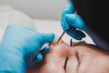 Kaşıkla yüzün mekanik olarak temizlenmesi, yağ ve siyah noktaların çıkarılması. yeni