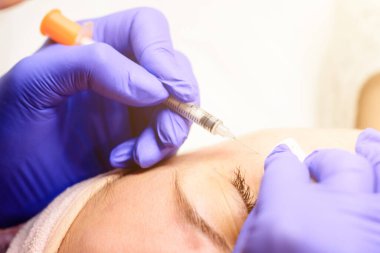 Yüzünde milisler, bir güzellik uzmanı tarafından sertleştirilmiş ve olgun miliaların çıkarılması. yeni