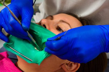 Diş hekimi kauçuk baraj, steril diş tedavisi, dişçide modern ekipman kurar. 2020