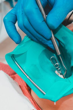 Diş sağlığı ve polimerizasyon malzemeleri, doktor diş restorasyonu hakkında steril çalışma yürütür. 2020