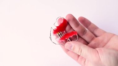 Dişleri hizalamak için çocuk plakasının incelenmesi, beyaz arka planda gözden geçirme.