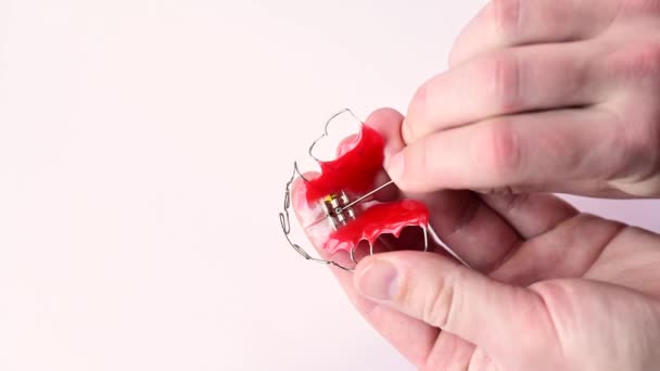 Allineamento di denti, torsione di un piatto per mezzo di una chiave speciale, cura di denti. — Video Stock