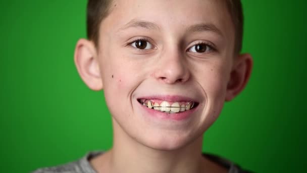 The child puts the plate on the upper curved teeth, aligning the curves of the upper teeth. — Stock Video