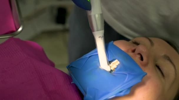 Dentiste en gants médicaux avec un appareil ultraviolet à la main travaille avec le patient, durcissant le remplissage de la dent. — Video