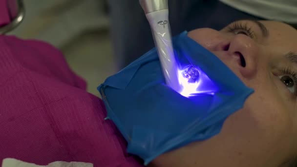 Dentiste en gants médicaux avec un appareil ultraviolet à la main travaille avec le patient, durcissant le remplissage de la dent. — Video