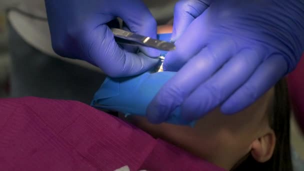 Dentiste en gants médicaux avec un appareil ultraviolet à la main travaille avec le patient, durcissant le remplissage de la dent. — Video