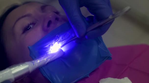 Équipement moderne dans une clinique dentaire, scellement des canaux, détecteur de caries ultraviolettes. — Video