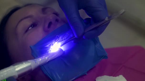 Attrezzature moderne in una clinica dentale, sigillatura dei canali, rilevatore di carie ultraviolette. — Video Stock