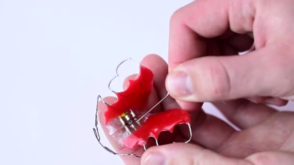 Justering af tænder, vridning af en plade ved hjælp af en særlig nøgle, pleje af tænder. – Stock-video