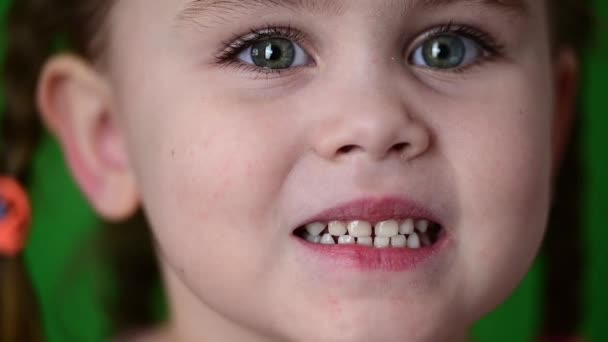 The girl shows her baby teeth, white baby teeth, oral hygiene, slow movement of the child. — Stock Video