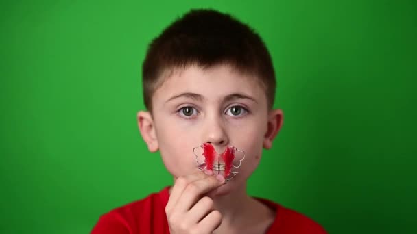 Un bambino di 9 anni tiene una piastra di allineamento dentale, un abominio e una dimostrazione di una piastra di allineamento dentale. — Video Stock