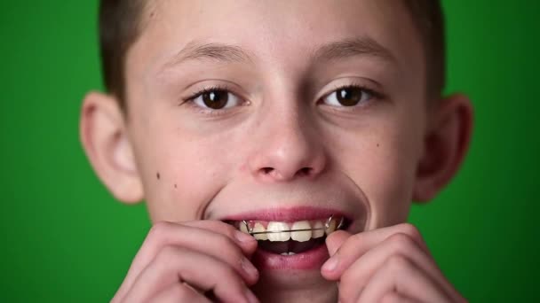 Çocuk çarpık dişlerin dizilişi için bir diş plakası takıyor, yeşil arka planda bir çocuğun portresi.. — Stok video