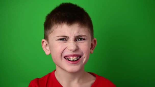 El chico sonríe, alinea sus dientes con una placa dental, cuidado dental. — Vídeo de stock