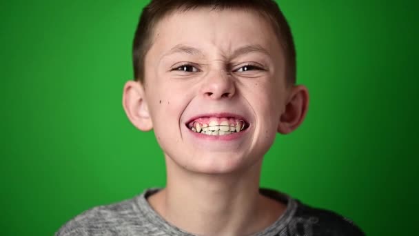 Smile baby, boy wears a plate for aligning teeth, dental care. — Stock Video