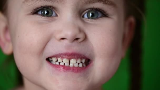 A menina mostra os dentes de leite, os dentes brancos do bebê, a higiene oral, o movimento lento da criança. — Vídeo de Stock