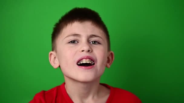 O menino está sorrindo, alinhando os dentes com uma placa dentária, atendimento odontológico. — Vídeo de Stock