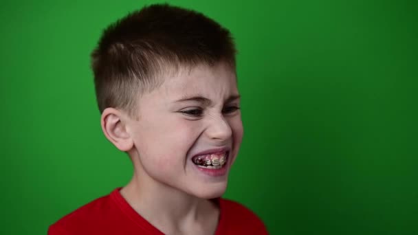 De jongen glimlacht, zijn tanden uitlijnen met een gebit, tandheelkundige verzorging. — Stockvideo