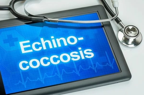 Compressa con la diagnosi di echinococcosi sul display — Foto Stock