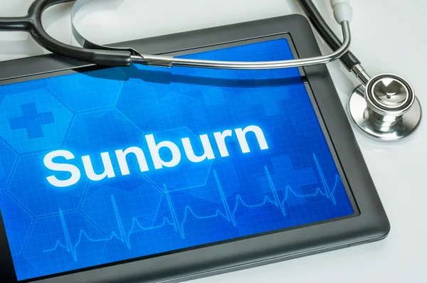 Tablet with the diagnosis Sunburn on the display — Stock Photo, Image