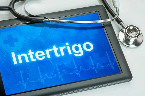 Tablett med diagnosen Intertrigo på displayen — Stockfoto