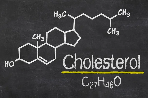 Tableau noir avec la formule chimique du cholestérol — Photo
