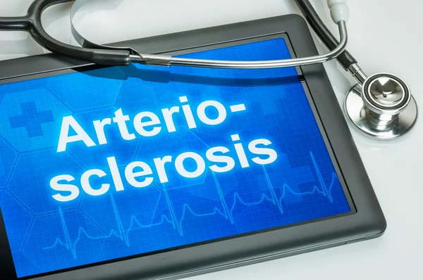 Tableta con el texto Arteriosclerosis en la pantalla —  Fotos de Stock