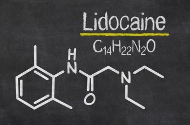 Blackboard with the chemical formula of Lidocaine clipart