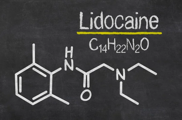 Pizarra con la fórmula química de la lidocaína — Foto de Stock