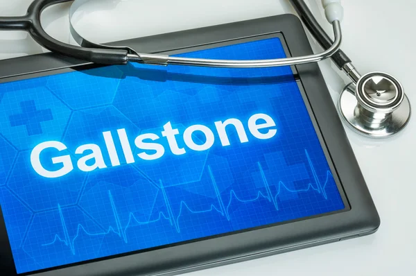 Tabletti, jossa on diagnoosi Gallstone näytöllä — kuvapankkivalokuva