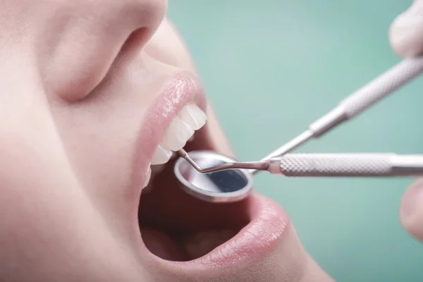 Mulher jovem e instrumento dentário — Fotografia de Stock