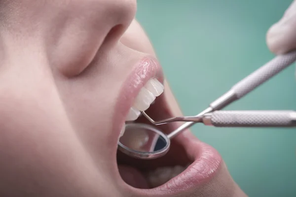 Mujer joven e instrumento dental — Foto de Stock