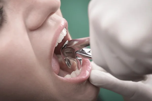 Mujer joven e instrumento dental — Foto de Stock