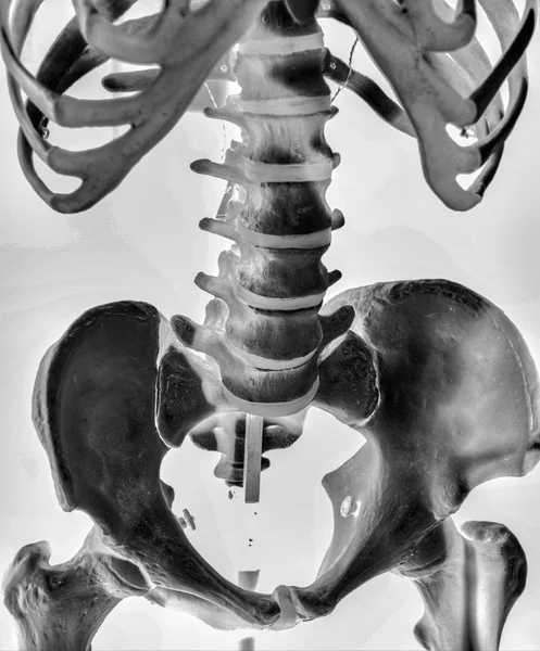 Skeleton — Stock Photo, Image