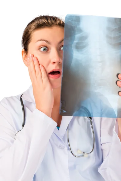Shocked doctor with x-ray ill patient — Stock Photo, Image
