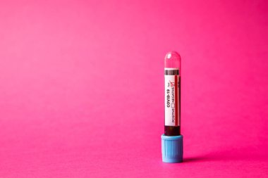 Pembe arka planda Covid-19 kan testi. Sonuçlar etiketlerde işaretli. Ön görünüm.