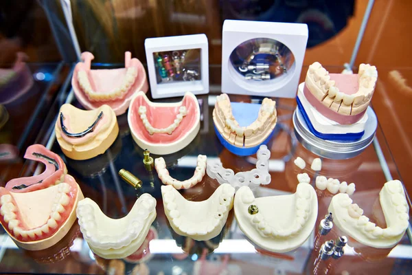 Umělé Zuby Čelisti Zubařské Výstavě — Stock fotografie
