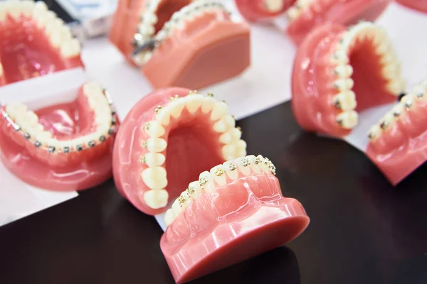 Modelos Dentes Com Aparelho Exposição Loja — Fotografia de Stock