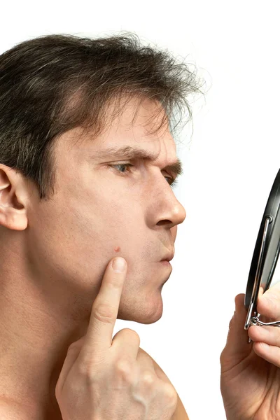 Men squeezing a pimple — Stock Photo, Image