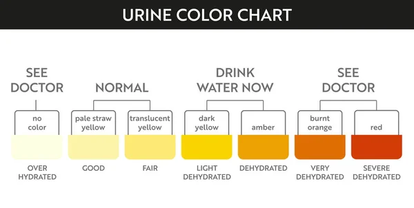 Grafico dei colori delle urine  . — Vettoriale Stock