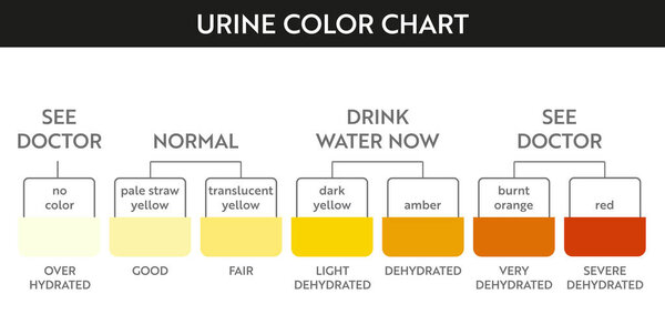 Urine color chart . 