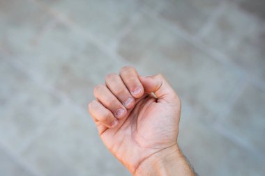 Tırnakları yenmiş ve çirkin bir adamın eli. Ellere kötü bakılıyor