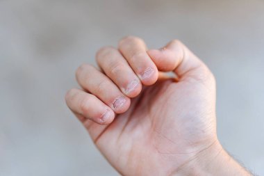 Tırnakları yenmiş ve çirkin bir adamın eli. Ellere kötü bakılıyor