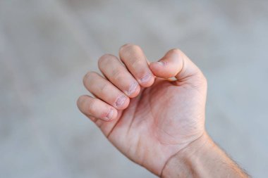 Tırnakları yenmiş ve çirkin bir adamın eli. Ellere kötü bakılıyor